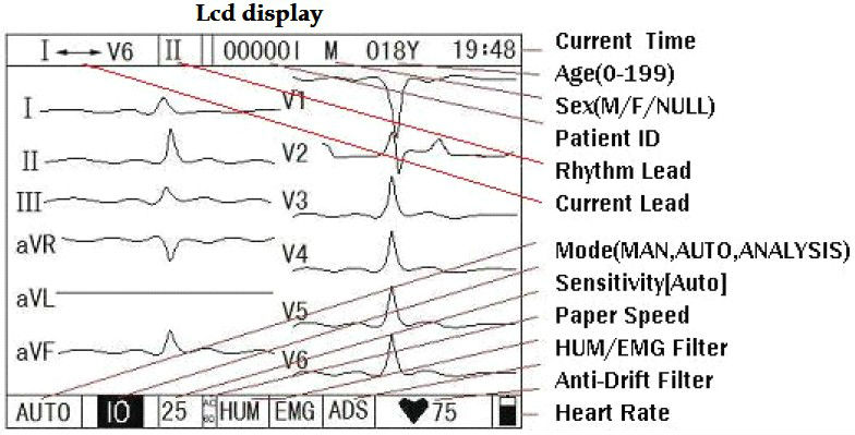 QWERTY楽しい英数字キーボードとUSBオート軽量ECG EKG問屋・仕入れ・卸・卸売り
