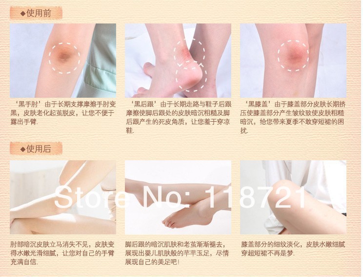 Gel Moisturizing Elbow Pads/Kee pad