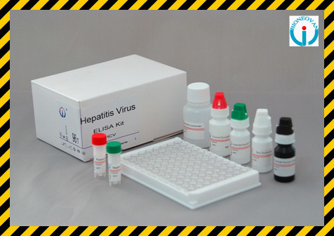 Elisaキットのための抗体をc型肝炎ウイルス( hcv) hcvelisa試薬問屋・仕入れ・卸・卸売り