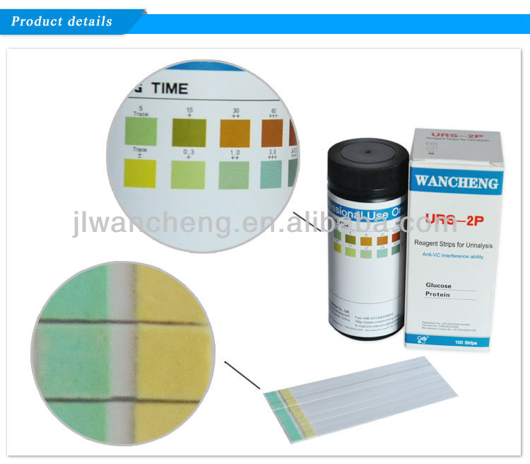 尿診断テストストリップ、 尿の感染症urs-2pのあまりにも痛み( a)問屋・仕入れ・卸・卸売り