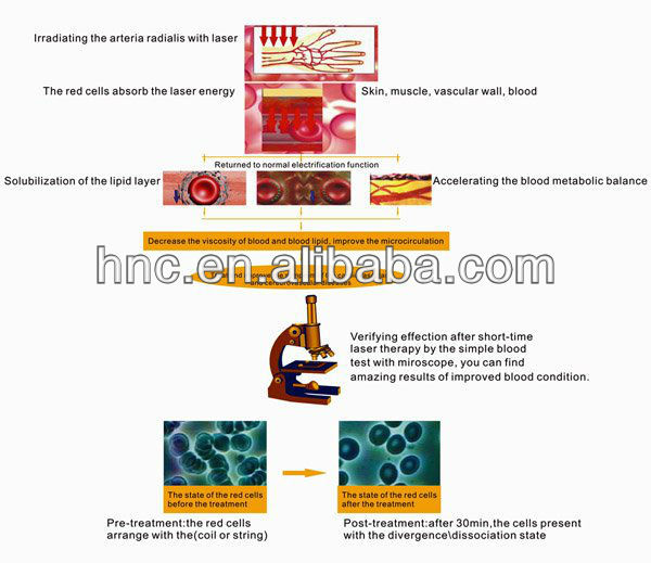 2014 Trending Hot Laser Therapy Instrument