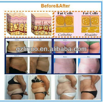 のalibabaエクスプレス! ポータブルcryolipolysis41の減量のマシン、 リポレーザー脂肪冷凍機、 キャビテーションrf痩身マシン問屋・仕入れ・卸・卸売り