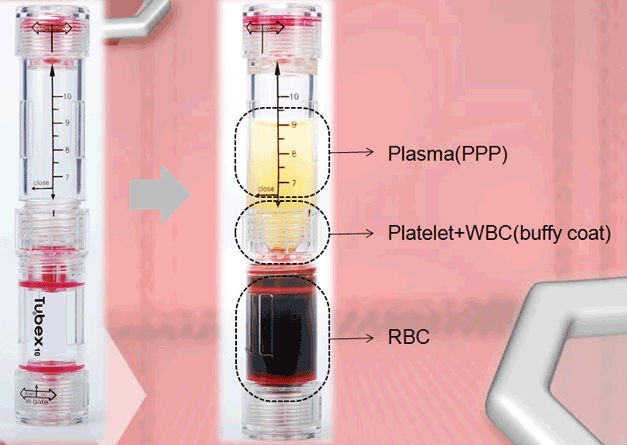 PRP Injections