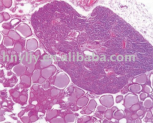 Parathyroid Slide