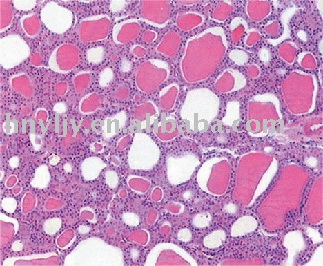 Thyroid Gland Slide