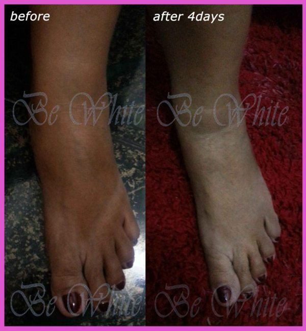 Can I Use The Papaya Kojic Acid Soap To Wash My Face Pictures to pin 