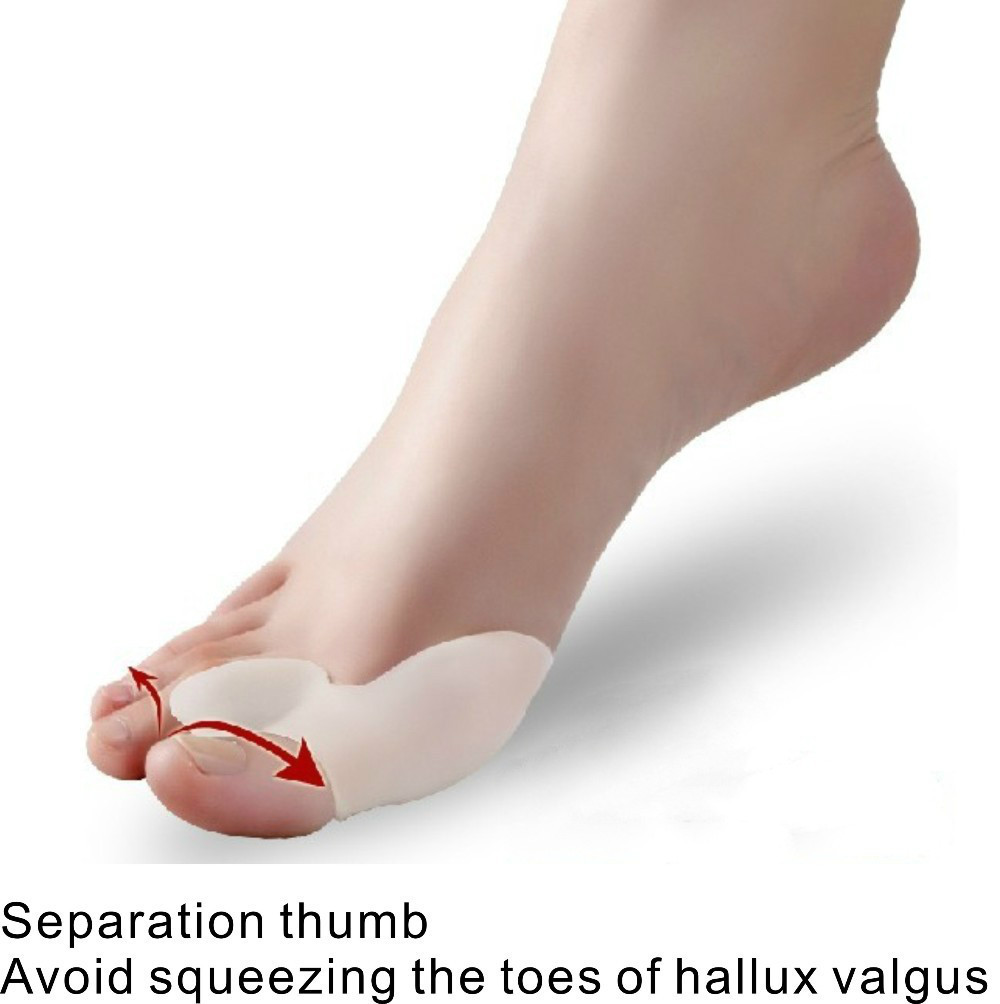 Hammer Toe