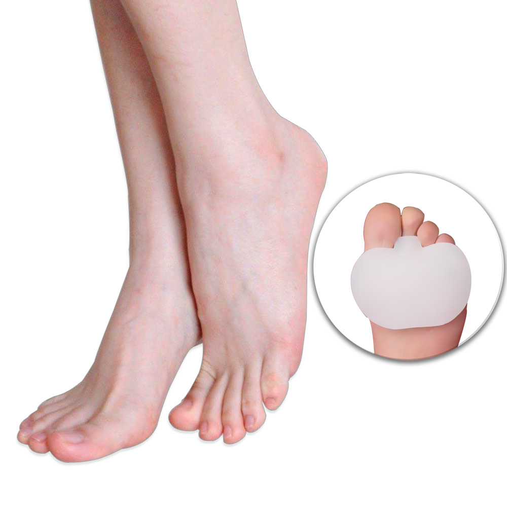 Hammertoe