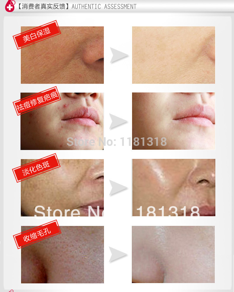 cicatrices sur le visage