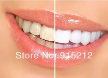 Brazil Free Shipping Popular White Teeth Whitening Pen Tooth Gel Whitener Bleach Remove Stains