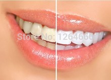 New Fashion 2014 Cheap Effective Whitening Tooth Tools Brand White Teeth Gel Pen