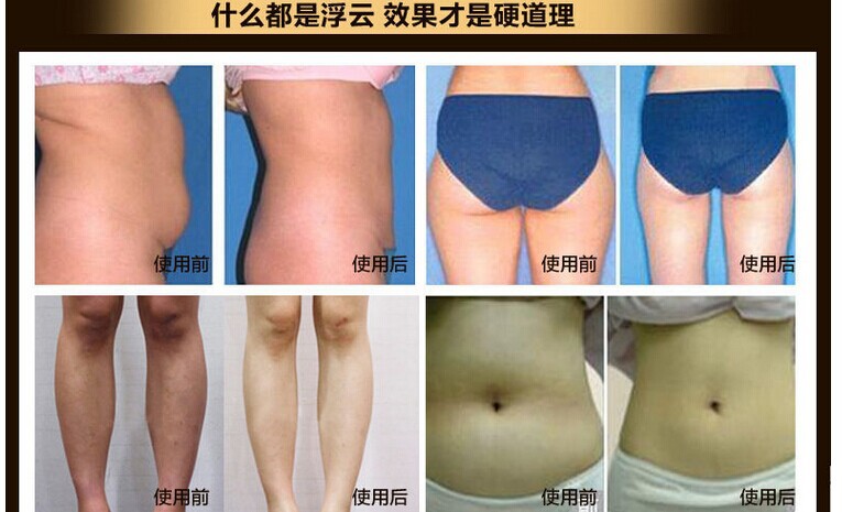 slimming creams Brand help sleep lose weight slimming Patch lose weight fat Navel Stick Burning Fat