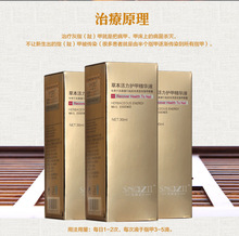 Chinese Herbal Fungal Nail Treatment Essence Nail and Foot Whitening Toe Nail Fungus Removal Feet Care