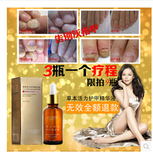Hot Sale Fungal Nail Treatment Essence Nail and Foot Whitening Toe Nail Fungus Removal Feet Care Nail Gel Free Shipping