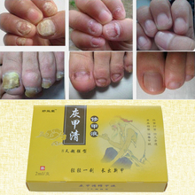 Fungal Nail Treatment TCM Essence Oil Hand and Foot Whitening Toe Nail Fungus Removal Feet Care