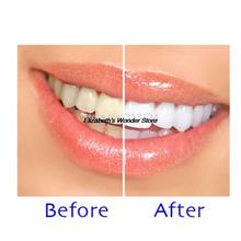 1set New Dental Equipment Teeth Whitening Dental Bleaching System Oral Gel Kit Tooth Whitener