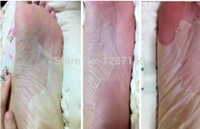 2pcs 1pair moisture Foot Callus peeling renewal remove dead skin Cuticles Heel smooth exfoliating feet mask
