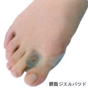 Bunions Callous