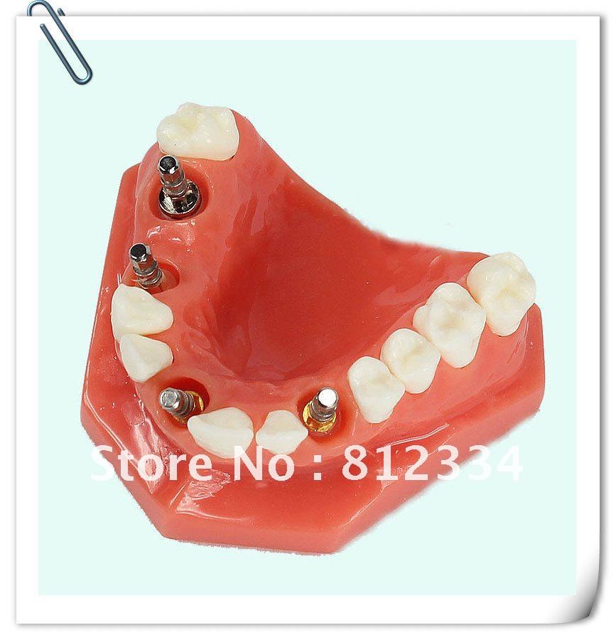 model tooth