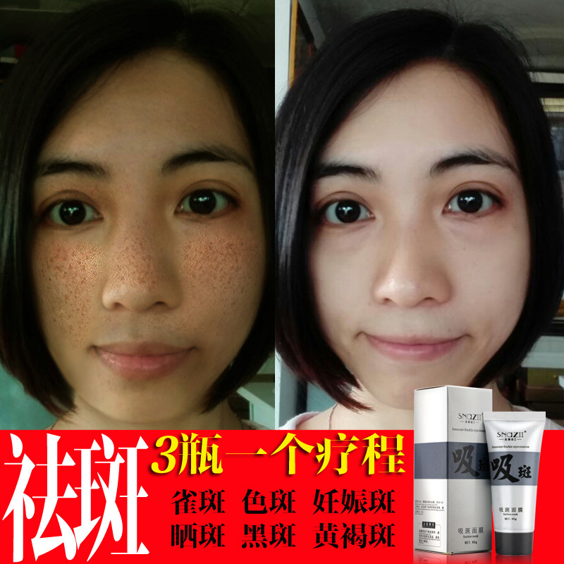 Mask Whitening and Spot Removal Products Moisturizing Acne Treatment 