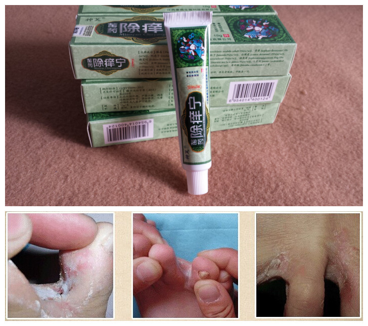 Hot Foot Cream Feet Care For Athlete s foot blisters peeling Feet itchy erosive beriberi bad
